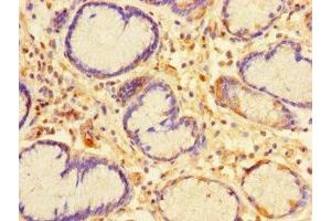 Immunohistochemistry of paraffin-embedded human stomach tissue using ABIN7146737 at dilution of 1:100 (CA11 Antikörper  (AA 24-328))