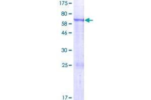 Image no. 1 for Ectonucleotide pyrophosphatase/phosphodiesterase 6 (ENPP6) (AA 1-440) protein (GST tag) (ABIN1352831) (ENPP6 Protein (AA 1-440) (GST tag))