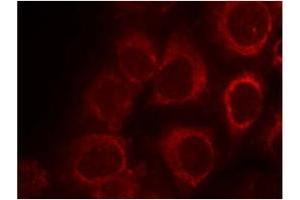 Image no. 1 for anti-SMAD, Mothers Against DPP Homolog 1 (SMAD1) (AA 461-465) antibody (ABIN319351) (SMAD1 Antikörper  (AA 461-465))