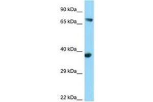 Image no. 1 for anti-FYN-Binding Protein (FYB) (AA 39-88) antibody (ABIN6748114)