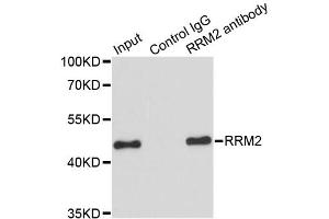 Immunoprecipitation analysis of 200ug extracts of HeLa cells using 1ug RRM2 antibody. (RRM2 Antikörper)