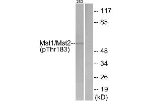 Western blot analysis of extracts from 293 cells, treated with H2O2 (100uM, 15 mins), using Mst1/2 (Phospho-Thr183) antibody. (MST1/MST2 (pThr183) Antikörper)