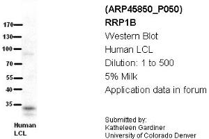Image no. 2 for anti-Ribosomal RNA Processing 1 Homolog B (RRP1B) (Middle Region) antibody (ABIN2782382) (RRP1B Antikörper  (Middle Region))
