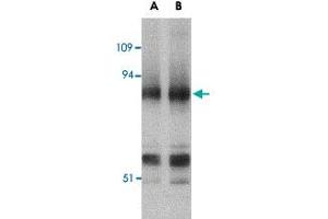 Western blot analysis of PRDM1 in mouse lung tissue lysate with PRDM1 polyclonal antibody  at (A) 0. (PRDM1 Antikörper  (N-Term))