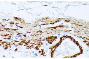 Immunohistochemistry of paraffin-embedded Human stomach using TPM2 Polyclonal Antibody at dilution of 1:100 (40x lens). (TPM2 Antikörper)