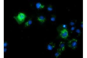 Anti-CALCOCO2 mouse monoclonal antibody (ABIN2453950) immunofluorescent staining of COS7 cells transiently transfected by pCMV6-ENTRY CALCOCO2 (RC203843). (CALCOCO2 Antikörper)