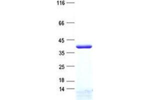 Validation with Western Blot (ZCCHC16 Protein (His tag))