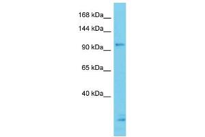 Host: Rabbit Target Name: CCDC132 Sample Type: ACHN Whole cell lysates Antibody Dilution: 1. (Syndetin/VPS50 Antikörper  (N-Term))