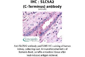 Image no. 1 for anti-Solute Carrier Family 5 (Sodium/glucose Cotransporter), Member 2 (SLC5A2) (C-Term) antibody (ABIN1739396) (SLC5A2 Antikörper  (C-Term))