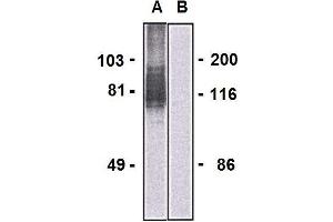 Western blotting analysis of LARGE1 in HEK293-LARGE1 transfectants (A) and HEK293 cells (B) using mouse monoclonal antibody (clone LARGE-02). (LARGE1 (AA 35-142) Antikörper (PE))