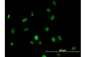 Immunofluorescence of monoclonal antibody to HDAC1 on HeLa cell. (HDAC1 Antikörper  (AA 1-482))