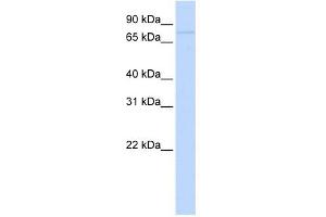 RNF43 antibody used at 1 ug/ml to detect target protein. (RNF43 Antikörper  (Middle Region))