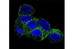 Confocal immunofluorescent analysis of b-Tubulin antibody with HepG2 cells followed by Alexa Fluor 488-conjugated goat anti-mouse lgG (green). (TUBB1 Antikörper)