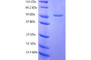 SDS-PAGE (SDS) image for Fibroblast Growth Factor 10 (FGF10) (AA 38-208) protein (GST tag) (ABIN5709519) (FGF10 Protein (AA 38-208) (GST tag))