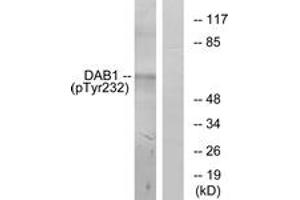 Western blot analysis of extracts from LOVO cells, using Dab1 (Phospho-Tyr232) Antibody.
