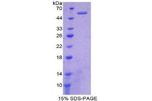 SDS-PAGE (SDS) image for Complement Factor I (CFI) (AA 28-243) protein (His tag,GST tag) (ABIN1981037) (Complement Factor I Protein (CFI) (AA 28-243) (His tag,GST tag))