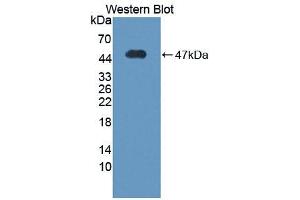 Western blot analysis of the recombinant protein. (Vitronectin Antikörper  (AA 21-400))