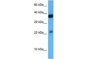 Host:  Mouse  Target Name:  CREB1  Sample Tissue:  Mouse Kidney  Antibody Dilution:  1ug/ml (CREM Antikörper  (C-Term))