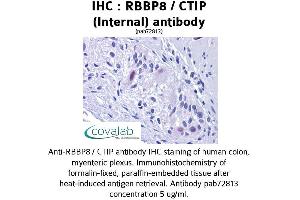 Image no. 2 for anti-Retinoblastoma Binding Protein 8 (RBBP8) (Internal Region) antibody (ABIN1738768) (Retinoblastoma Binding Protein 8 Antikörper  (Internal Region))
