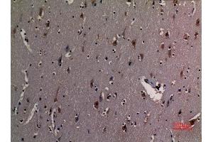 Immunohistochemistry (IHC) image for anti-X-Ray Repair Complementing Defective Repair in Chinese Hamster Cells 6 (XRCC6) (acLys542) antibody (ABIN3181890)