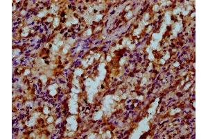 IHC image of ABIN7175529 diluted at 1:200 and staining in paraffin-embedded human lung tissue performed on a Leica BondTM system. (VKORC1 Antikörper  (AA 30-74))
