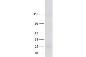 Western Blotting (WB) image for Fibroblast Growth Factor 7 (FGF7) protein (Myc-DYKDDDDK Tag) (ABIN2721095)