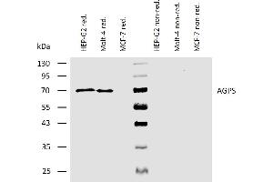 Western blotting analysis of human AGPS using mouse monoclonal antibody AGPS-03 on lysates of HEP-G2 and Molt-4 cells, and MCF-7 cells (negative control) under reducing and non-reducing conditions. (AGPS Antikörper  (AA 158-384))