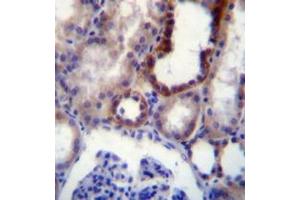 Immunohistochemistry analysis in formalin fixed and paraffin embedded (FFPE) human kidney tissue using CD316 / IGSF8 Antibody , followed by peroxidase conjugation of the secondary antibody and DAB staining. (IGSF8 Antikörper  (Middle Region))