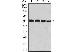 Western Blotting (WB) image for anti-Bridging Integrator 1 (BIN1) (AA 189-398) antibody (ABIN5858685) (BIN1 Antikörper  (AA 189-398))