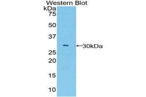 Western blot analysis of the recombinant protein. (BCL3 Antikörper  (AA 127-376))