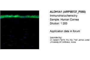 Sample Type: Human CorneaDilution: 1:200 (ALDH1A1 Antikörper  (Middle Region))