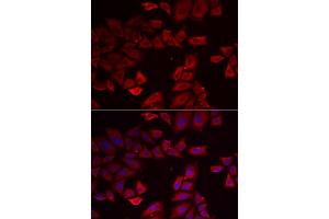 Immunofluorescence analysis of HeLa cells using SEPHS1 antibody (ABIN5973853). (SEPHS1 Antikörper)
