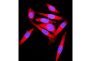 IF analysis of KLC1 using anti-KLC1 antibody (ABIN7599469). (KLC1 Antikörper  (AA 1-537))