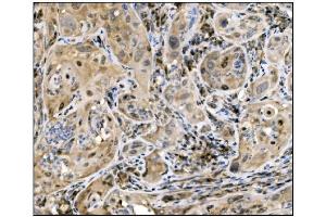 IHC analysis of Caspase-9/CASP9 using anti-Caspase-9/CASP9 antibody (ABIN7600340). (Caspase 9 Antikörper  (AA 18-416))