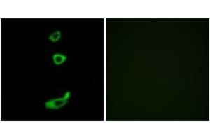 Immunofluorescence analysis of MCF7 cells, using CRHR1 Antibody.