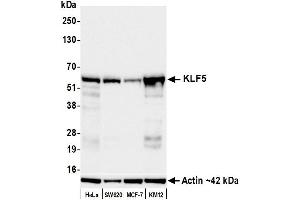 Western Blotting (WB) image for anti-Kruppel-Like Factor 5 (Intestinal) (KLF5) (AA 325-375) antibody (ABIN7795630)
