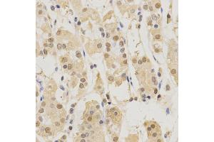 Immunohistochemistry of paraffin-embedded human stomach using PSMB5 antibody (ABIN5971025) at dilution of 1/200 (40x lens).
