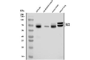 Western blot analysis of KLC1 using anti-KLC1 antibody (ABIN7599469). (KLC1 Antikörper  (AA 1-537))