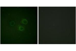 Immunofluorescence analysis of A549 cells, using CD226/DNAM-1 (Phospho-Ser329) Antibody. (CD226 Antikörper  (pSer329))
