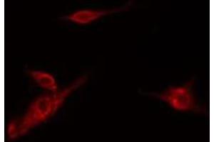 ABIN6278579 staining Hela cells by IF/ICC. (HK3 Antikörper  (Internal Region))