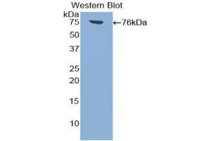 Western Blotting (WB) image for anti-Intercellular Adhesion Molecule 1 (ICAM1) (AA 26-480) antibody (ABIN1859239) (ICAM1 Antikörper  (AA 26-480))