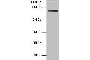 Western blot All lanes: MTHFR antibody at 2 μg/mL + 293T whole cell lysate Secondary Goat polyclonal to rabbit IgG at 1/10000 dilution Predicted band size: 75, 79 kDa Observed band size: 75 kDa (MTHFR Antikörper  (AA 1-656))