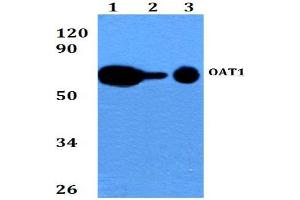Western blot  analysis of SLC22A6 / OAT1 Antibody at 1/500 dilution.
