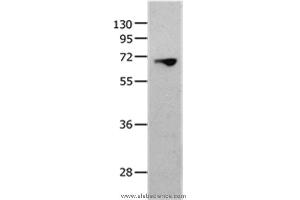 Western blot analysis of 823 cell, using MMP25 Polyclonal Antibody at dilution of 1:1300 (MMP25 Antikörper)
