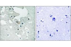 Immunohistochemistry analysis of paraffin-embedded human brain, using BLNK (Phospho-Tyr84) Antibody. (B-Cell Linker Antikörper  (pTyr84))