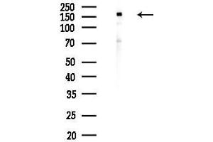 anti-RAD54-Like 2 (RAD54L2) antibody