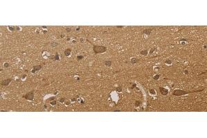 Immunohistochemistry of paraffin-embedded Human brain tissue using CSNK2B Polyclonal Antibody at dilution of 1:30(x200) (CSNK2B Antikörper)
