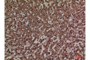 Immunohistochemistry (IHC) analysis of paraffin-embedded Human Liver, antibody was diluted at 1:100.