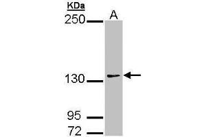 WB Image Sample (30 ug of whole cell lysate) A: 293T 7. (AUTS2 Antikörper  (Internal Region))