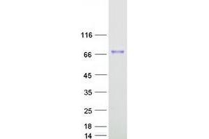Western Blotting (WB) image for Cirrhosis, Autosomal Recessive 1A (Cirhin) (CIRH1A) protein (Myc-DYKDDDDK Tag) (ABIN2714195)